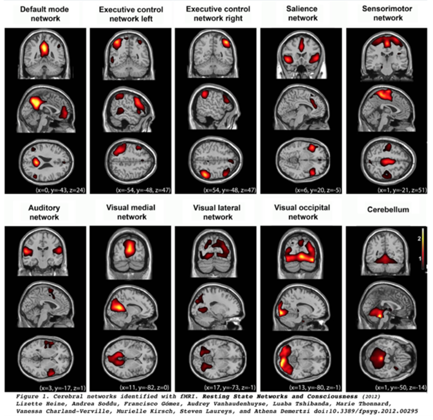 図3　fMRIスキャンが示す大規模脳ネットワーク (Wikipediaより)
